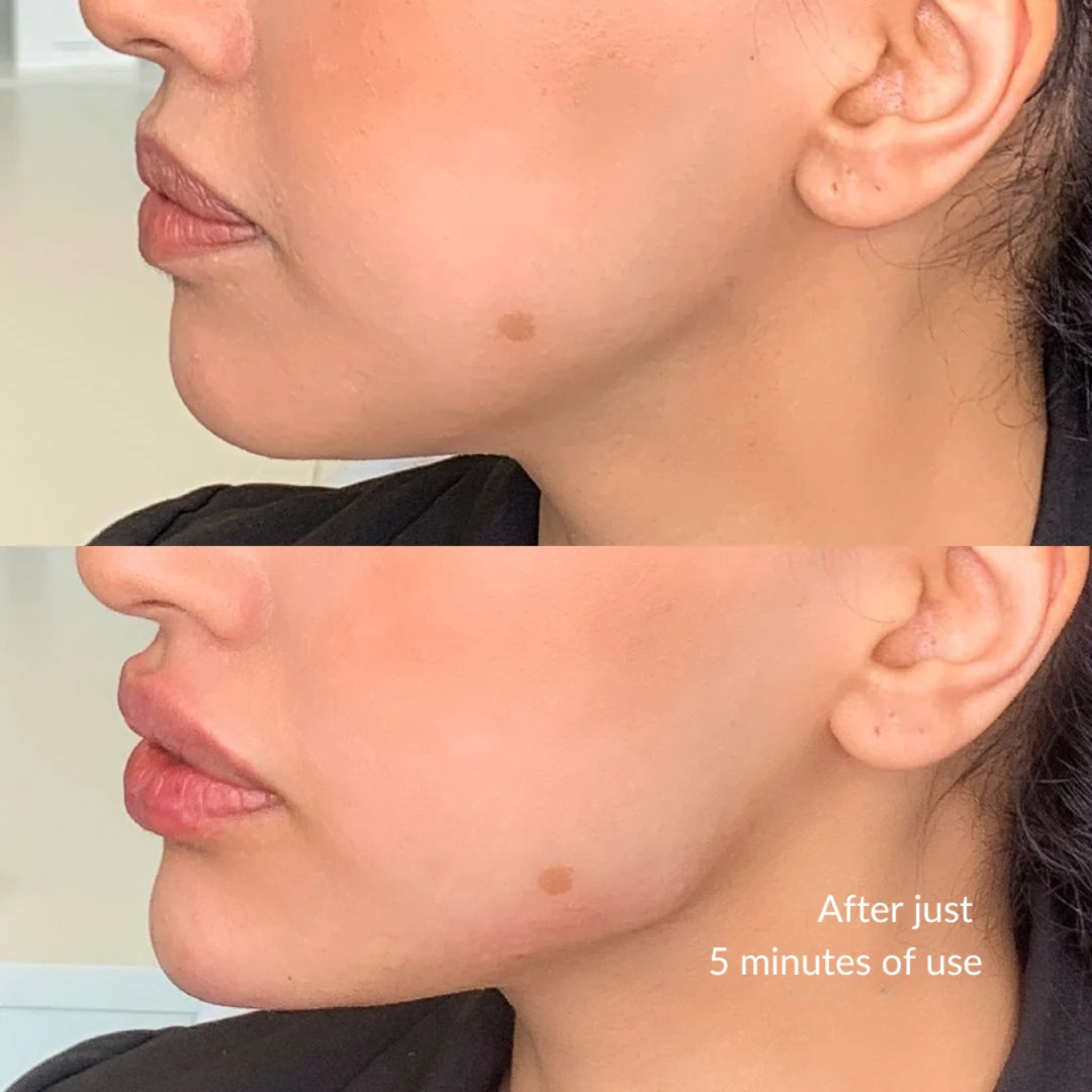 Lymphatic Face Brush